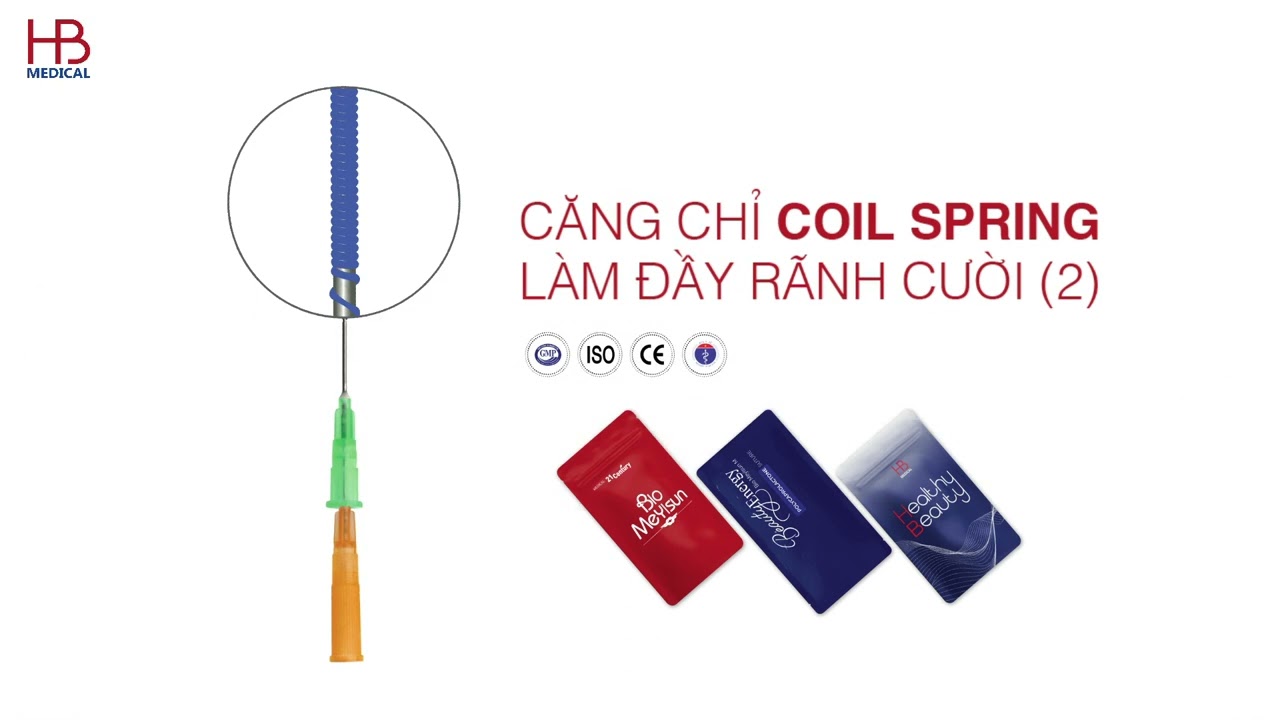 Căng chỉ làm đầy rãnh cười với Coil Spring