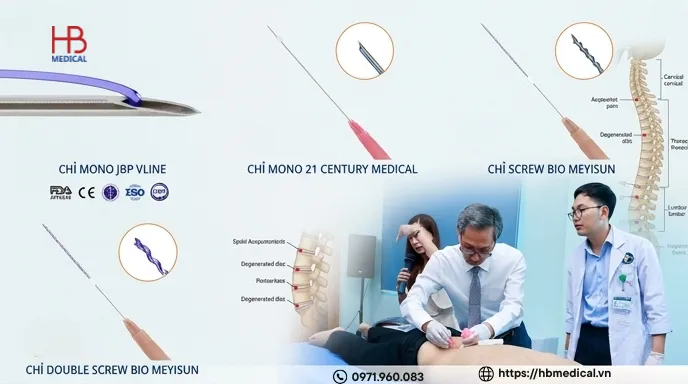 Cấy chỉ trong điều trị thoái hoá cột sống