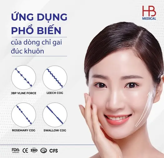 Khi nào bác sĩ nên chọn chỉ gai đúc khuôn trong nâng cơ thẩm mỹ?