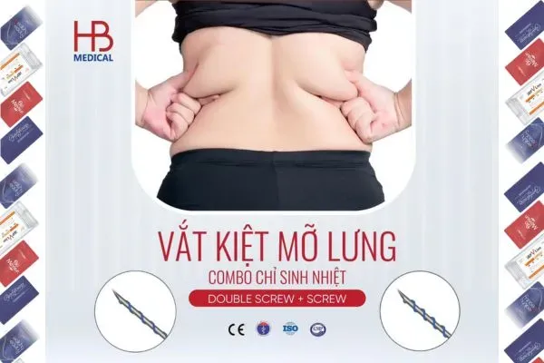 Cấy Chỉ Giảm Mỡ Lưng Bằng Combo Screw – Double Screw: Phác Đồ Được Bác Sĩ Ứng Dụng Hiện Nay