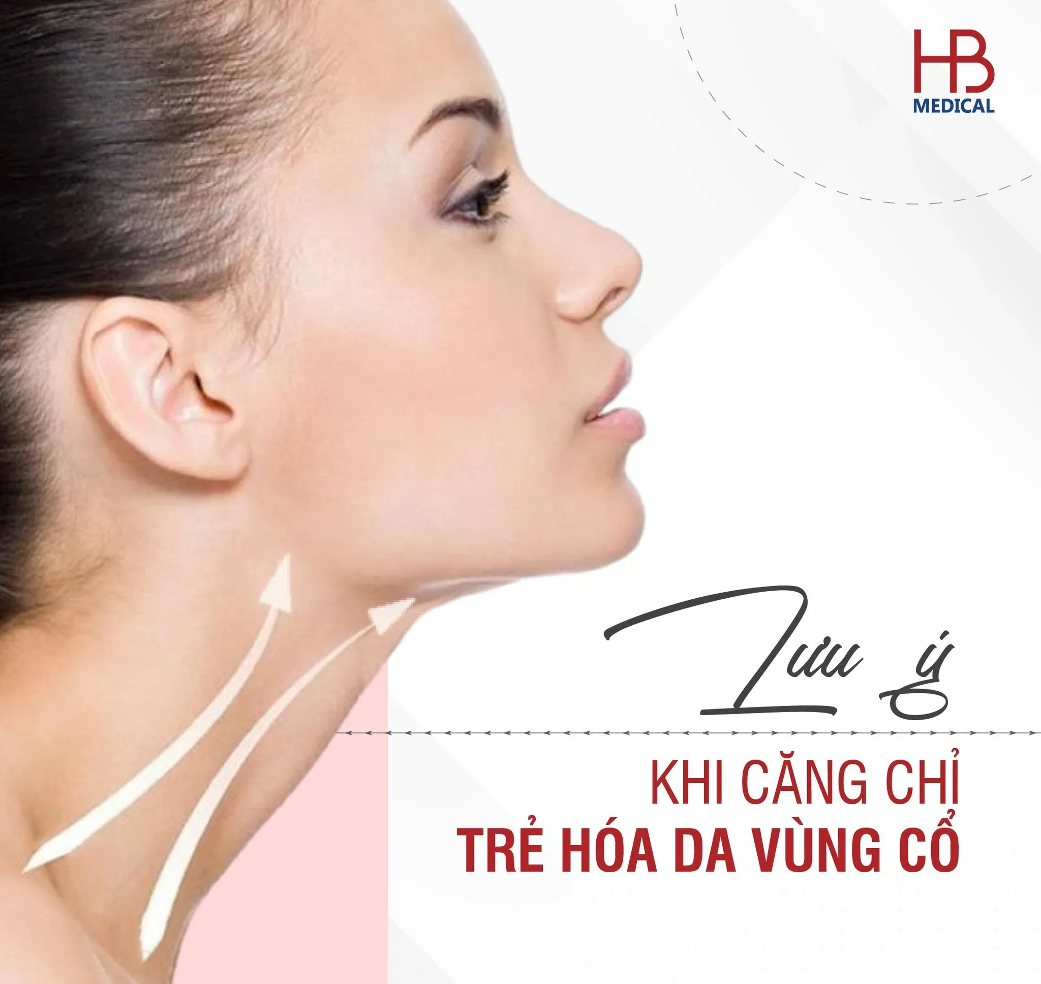 Bác sĩ cần lưu ý gì khi căng chỉ trẻ hóa da vùng cổ?