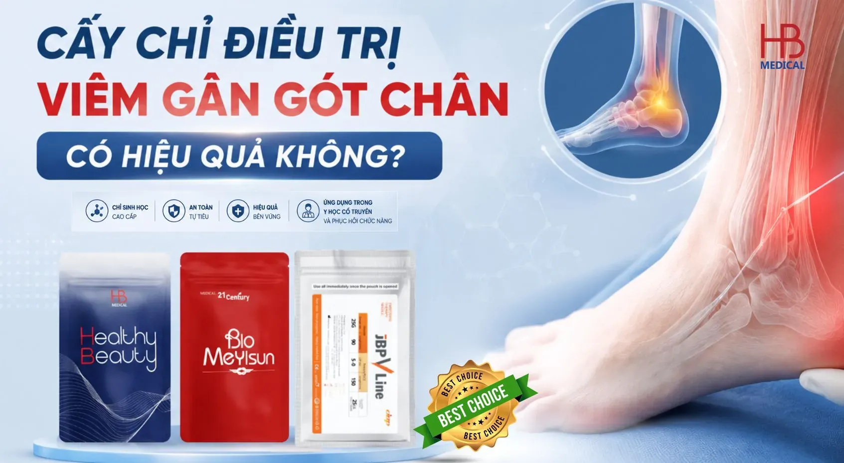 Cấy chỉ điều trị viêm gân gót chân có hiệu quả không?