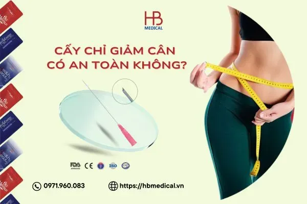 Cấy chỉ giảm cân có an toàn không?