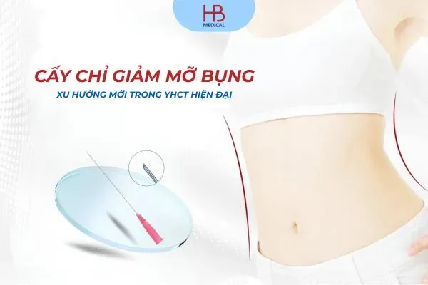 Cấy chỉ giảm mỡ bụng – Xu hướng mới trong YHCT hiện đại