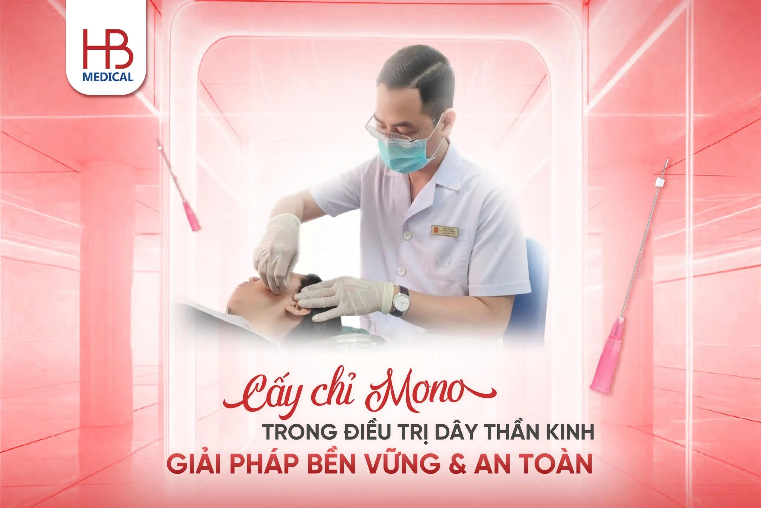 Cấy chỉ Mono trong điều trị đau dây thần kinh
