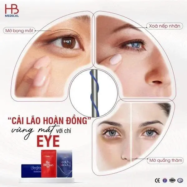 Chỉ mắt trong trẻ hóa vùng quanh mắt