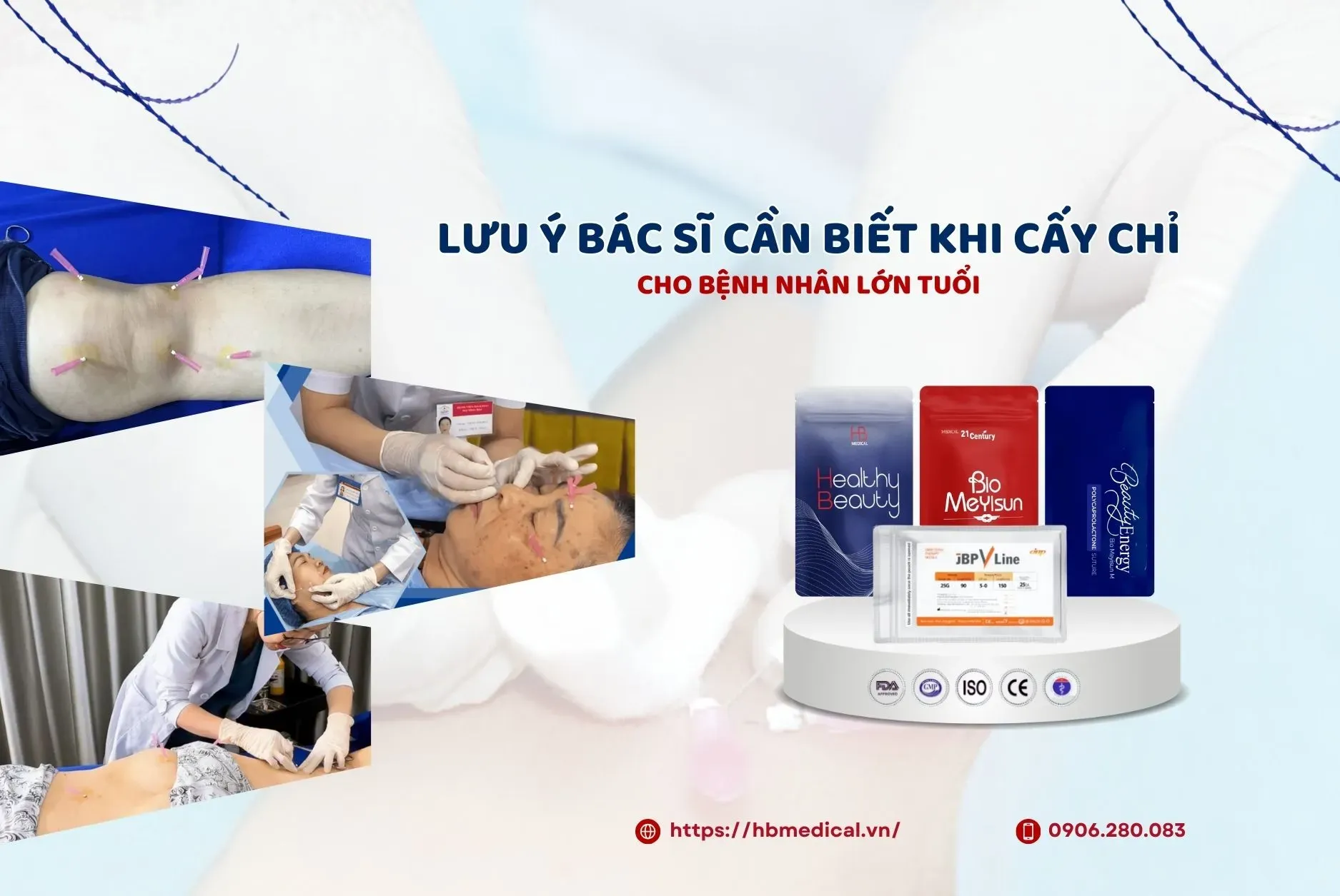 6 Lưu ý bác sĩ cần biết khi cấy chỉ cho bệnh nhân lớn tuổi