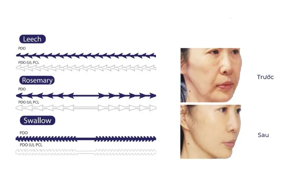 Molding Cog với đa dạng hình thái gai