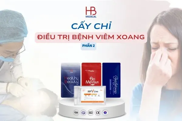 Hướng dẫn điều trị viêm xoang bằng cấy chỉ trong YHCT