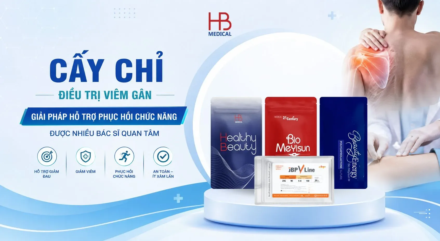 Cấy chỉ điều trị viêm gân