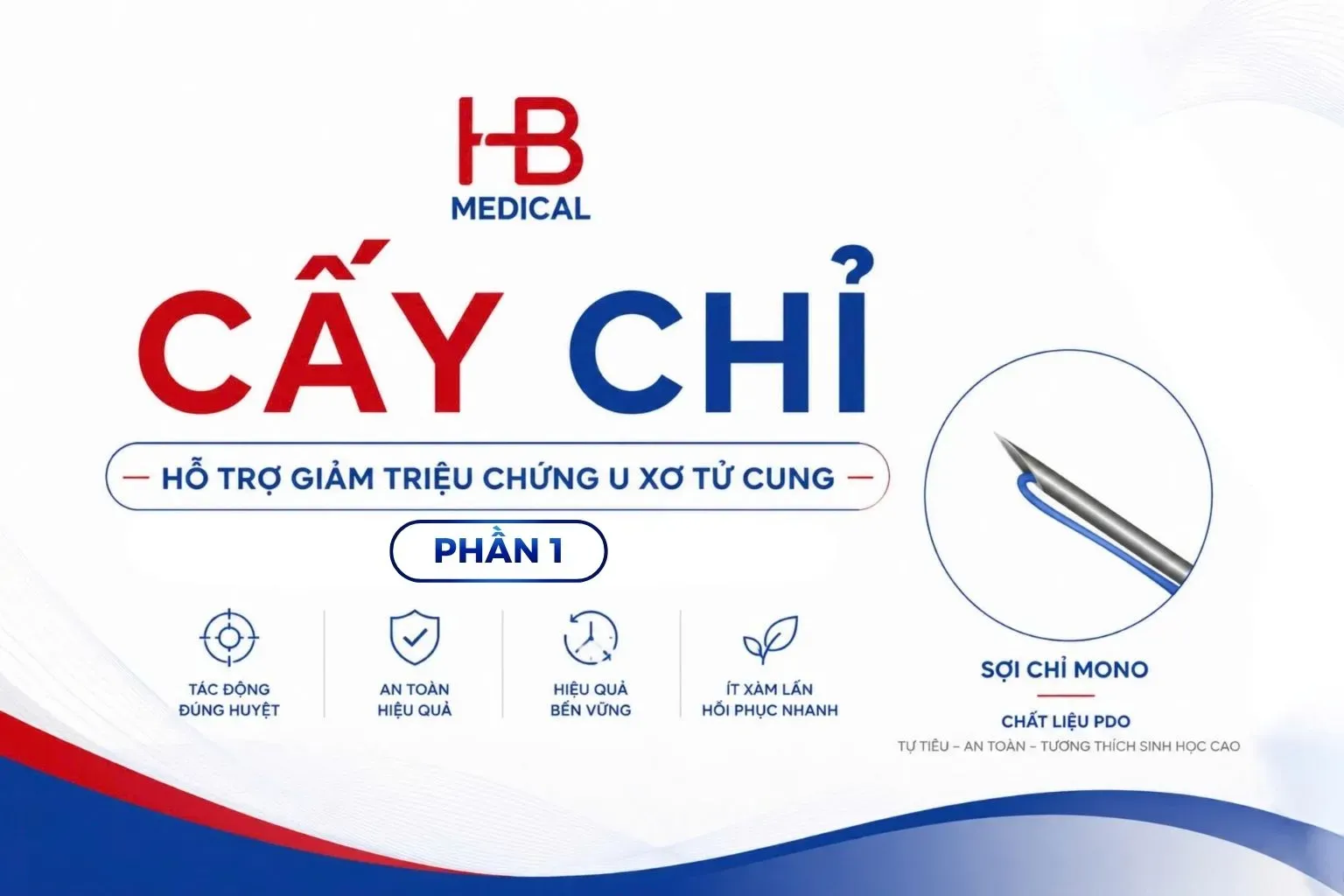 Cấy chỉ giảm u xơ tử cung