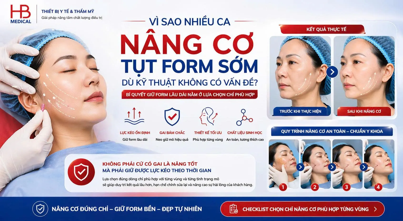 Vì sao nhiều ca nâng cơ tụt form sớm dù kỹ thuật không có vấn đề?