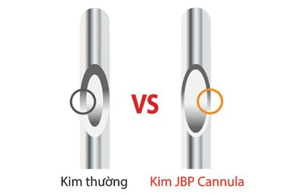 Phân biệt sản phẩm