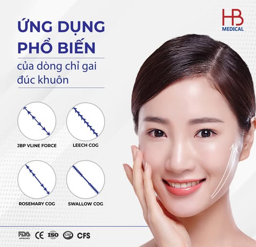 Khi nào bác sĩ nên chọn chỉ gai đúc khuôn trong nâng cơ thẩm mỹ?