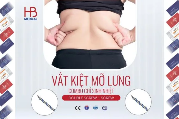 Cấy Chỉ Giảm Mỡ Lưng Bằng Combo Screw – Double Screw: Phác Đồ Được Bác Sĩ Ứng Dụng Hiện Nay