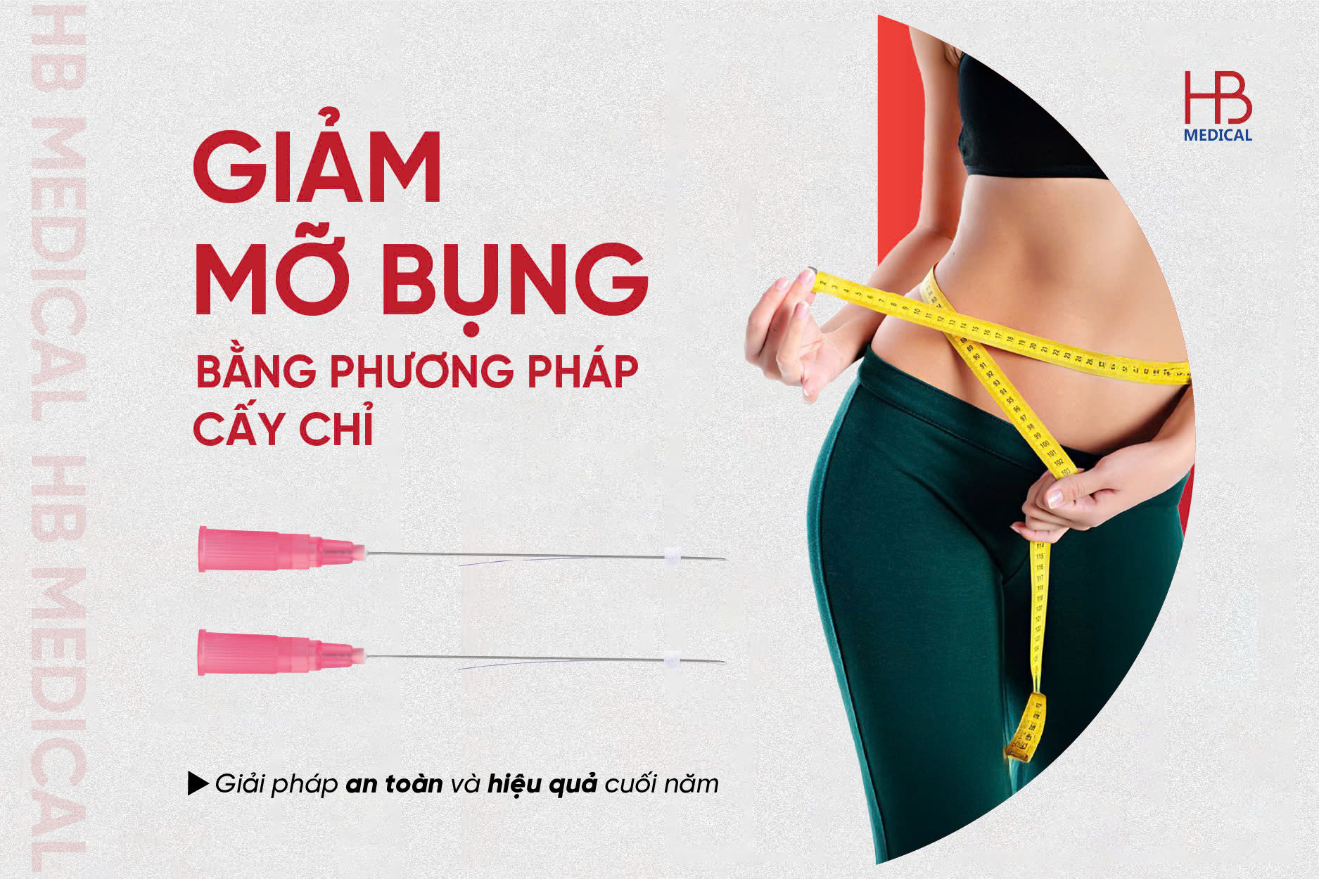 Giảm mỡ bụng bằng phương pháp cấy chỉ