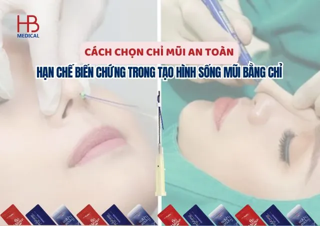 Cách chọn chỉ mũi an toàn – hạn chế biến chứng