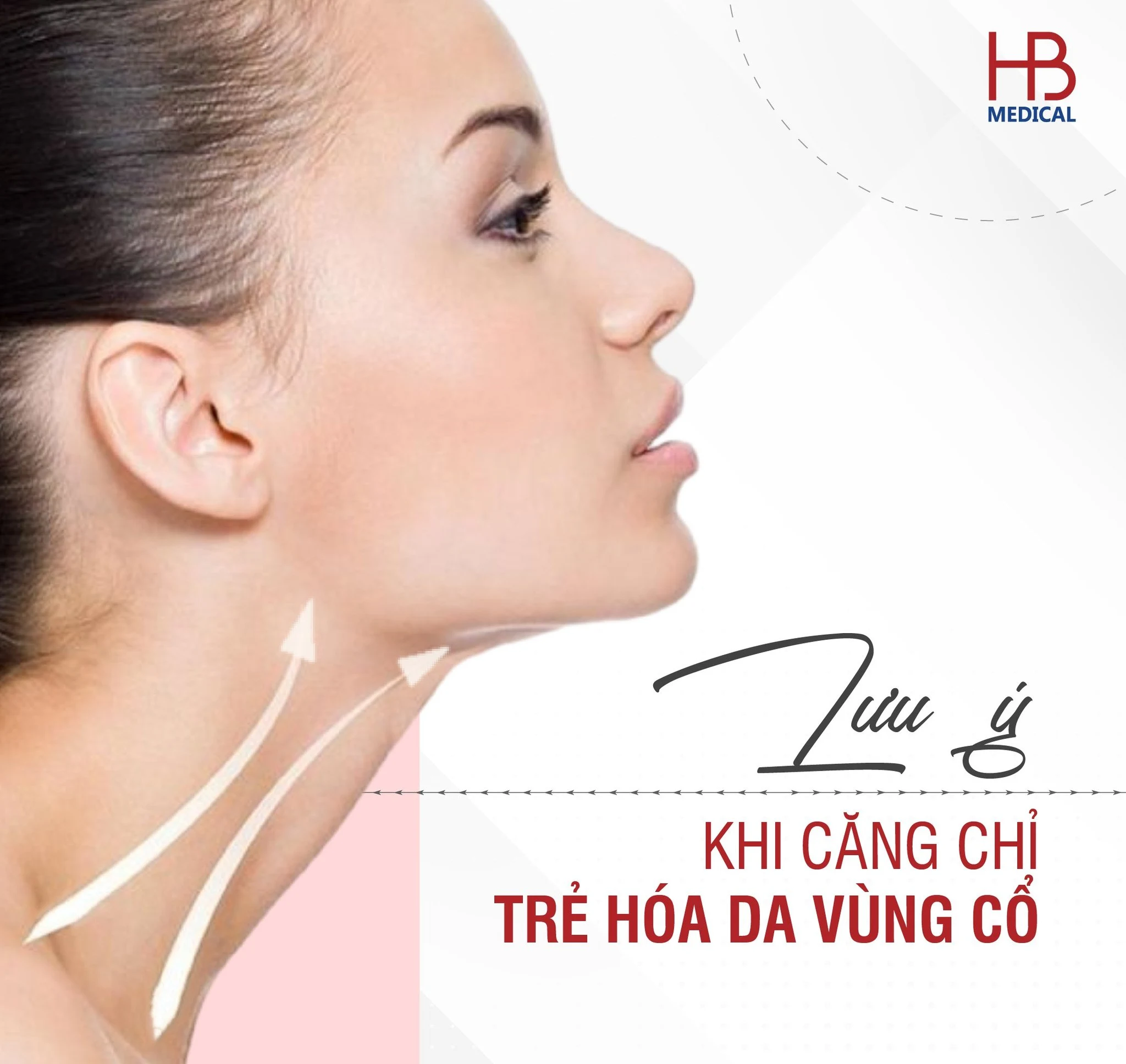 Bác sĩ cần lưu ý gì khi căng chỉ trẻ hóa da vùng cổ?