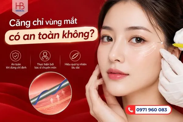 Căng chỉ vùng mắt có an toàn không?