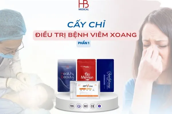 [Phần 1] Cập nhật kiến thức mới nhất về cấy chỉ điều trị viêm xoang trong YHCT