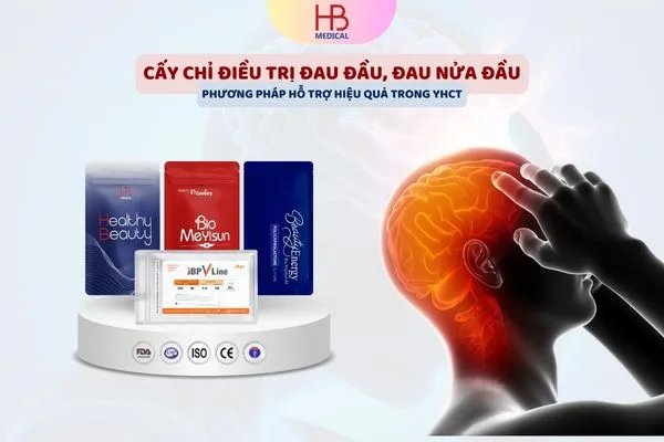 Cấy chỉ điều trị đau đầu, đau nửa đầu phương pháp hỗ trợ hiệu quả trong YHCT