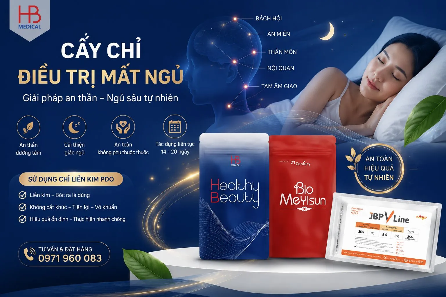 Cấy chỉ điều trị mất ngủ – Giải pháp an toàn giúp cải thiện giấc ngủ tự nhiên
