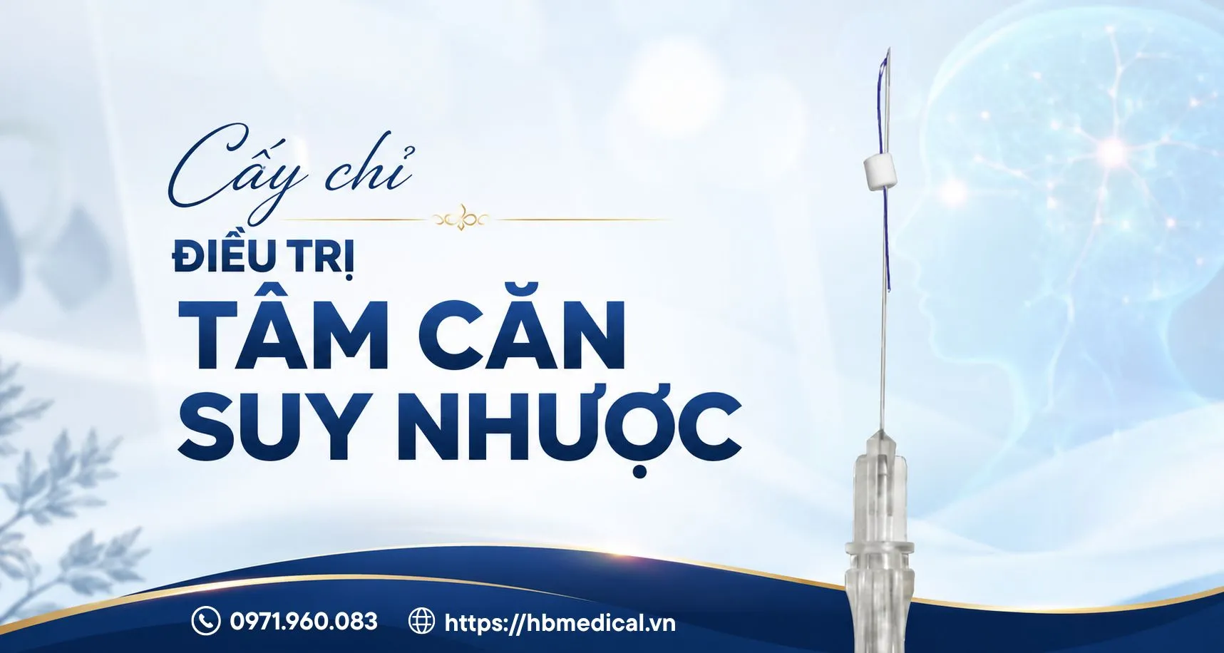 Cấy chỉ điều trị tâm căn suy nhược trong Y học cổ truyền
