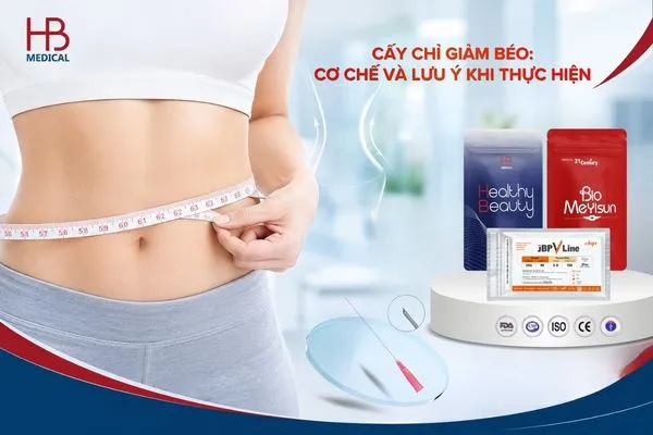 Cấy chỉ giảm béo: Vai trò hỗ trợ kiểm soát cân nặng
