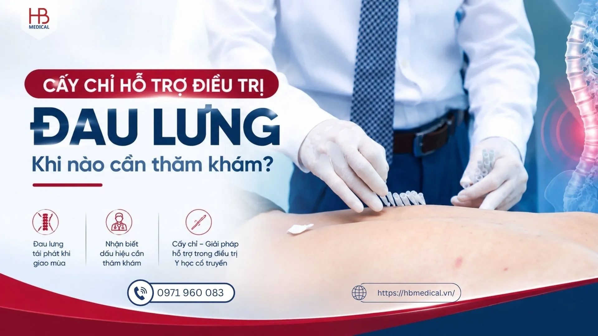 Cấy chỉ hỗ trợ điều trị đau lưng: Khi nào cần thăm khám?