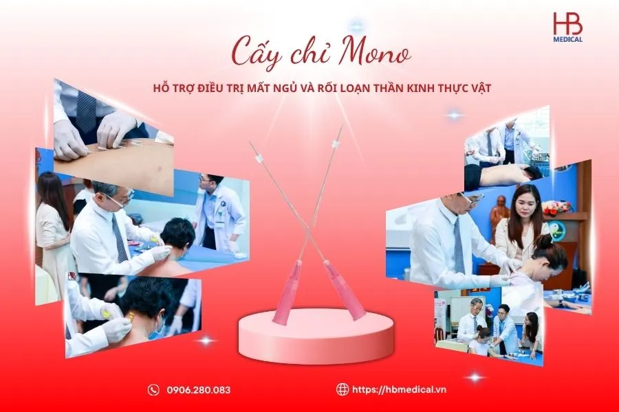 Cấy chỉ Mono hỗ trợ điều trị mất ngủ và rối loạn thần kinh thực vật