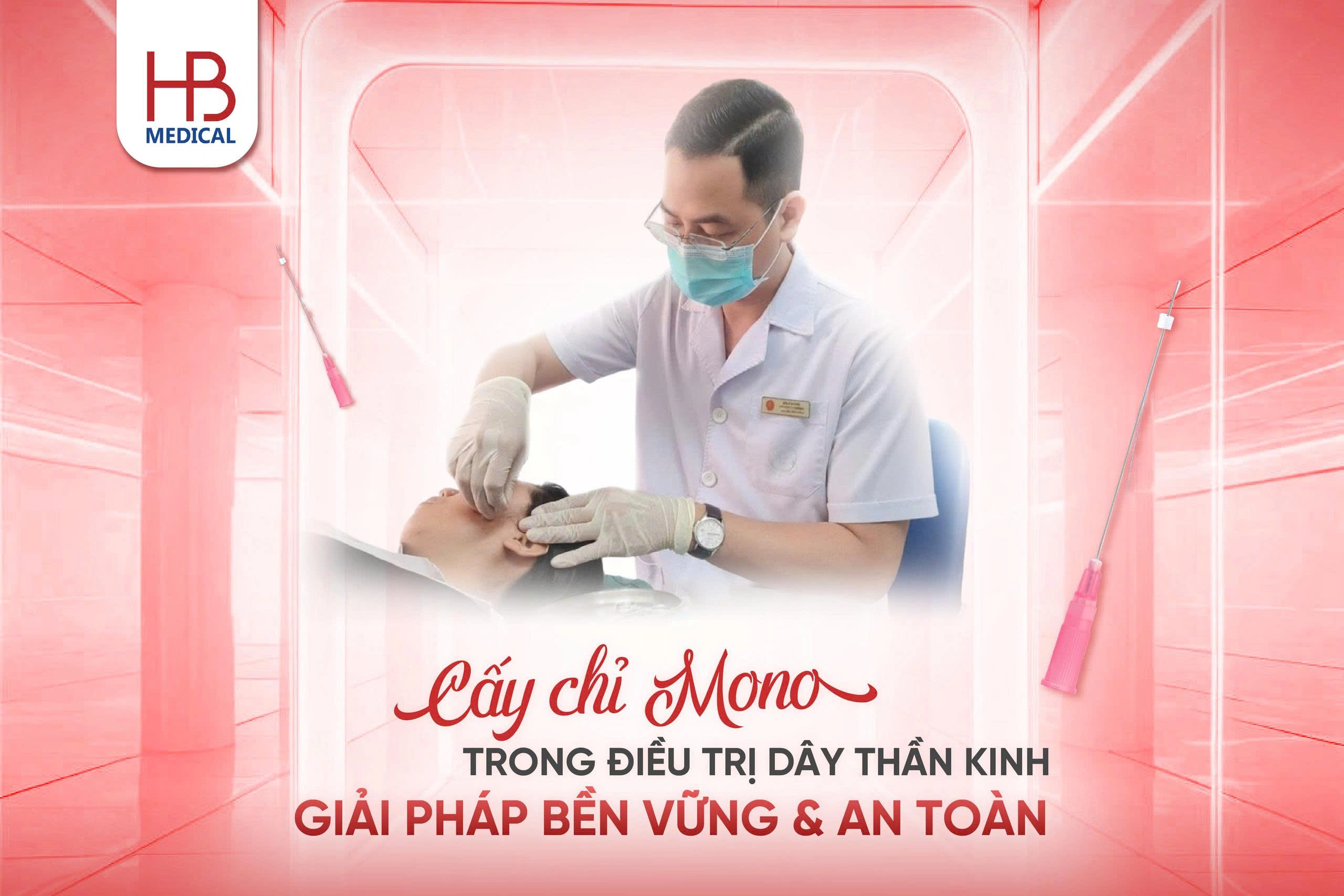 Cấy chỉ Mono trong điều trị đau dây thần kinh – Giải pháp bền vững và an toàn