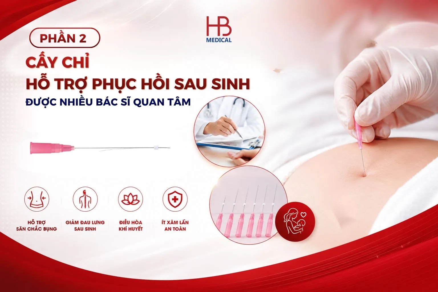 Cấy chỉ sau sinh: Bao lâu thì phù hợp và những điều bác sĩ cần lưu ý trước khi ứng dụng?