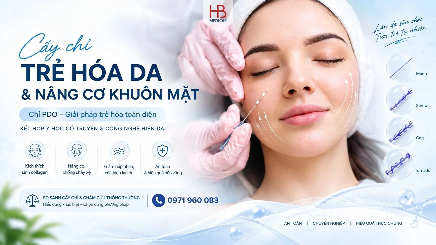Cấy chỉ trẻ hóa da bằng chỉ PDO: Khác gì châm cứu thông thường? Quy trình chuẩn theo QĐ 486/2026
