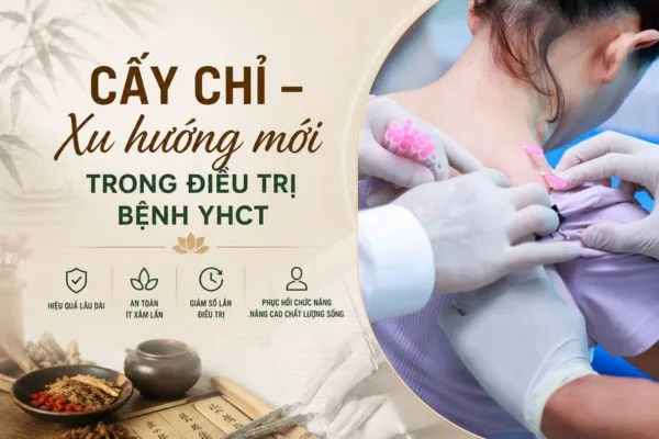 Cấy chỉ – Xu hướng mới trong điều trị bệnh YHCT