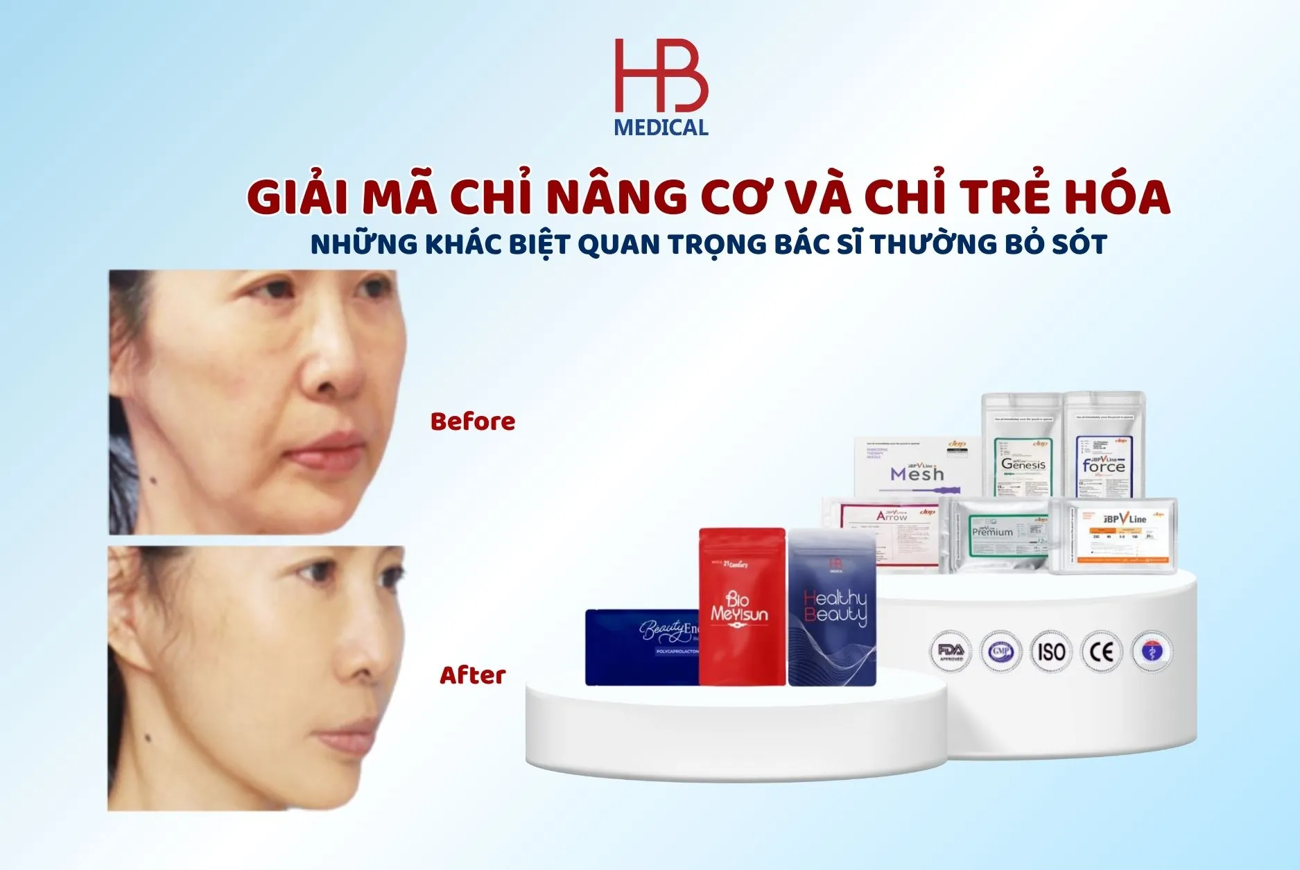 Giải mã chỉ nâng cơ và chỉ trẻ hóa: Những khác biệt quan trọng bác sĩ thường bỏ sót