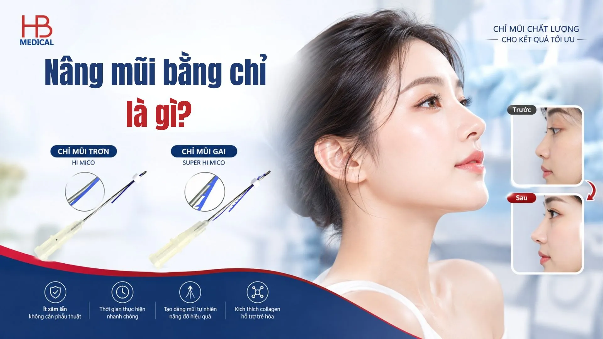 Nâng mũi bằng chỉ là gì? Quy trình thực hiện, rủi ro và hướng dẫn chăm sóc