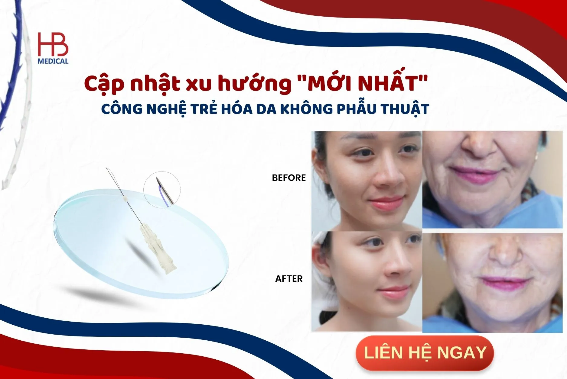 Cập nhật xu hướng "MỚI NHẤT"  công nghệ trẻ hóa da không phẫu thuật