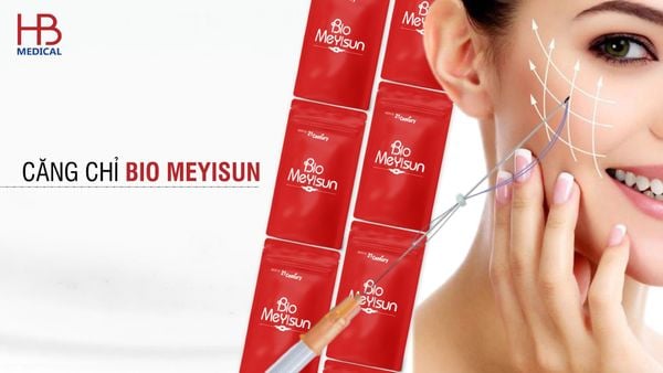 Căng chỉ Bio Meyisun là gì? Hiệu quả bao lâu? An toàn không?