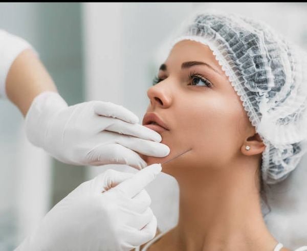 Căng chỉ nâng cơ mặt: Tìm hiểu giá cả và hiệu quả thực tế