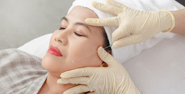 Hướng dẫn chăm sóc sau căng chỉ nâng cơ mặt để đạt hiệu quả tối đa