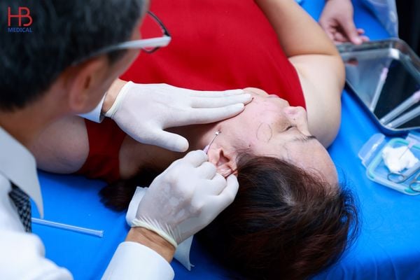 Hiệu quả căng chỉ collagen JBP Vline, Healthy Beauty, Bio Meyisun duy trì được bao lâu?
