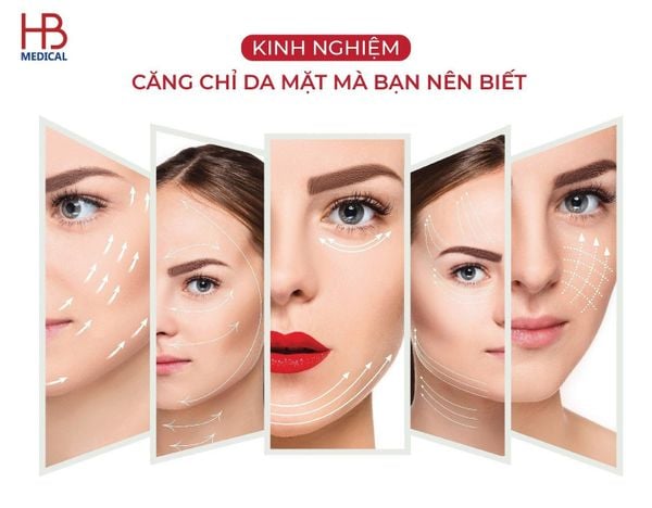 Kinh nghiệm căng chỉ da mặt mà bạn nên biết
