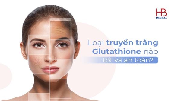 Loại truyền trắng Glutathione nào tốt và an toàn?
