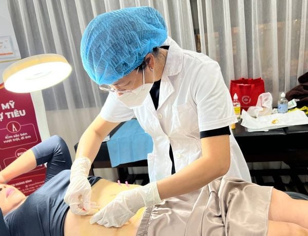 Quá trình giảm béo nhờ cấy chỉ vào huyệt diễn ra như thế nào?