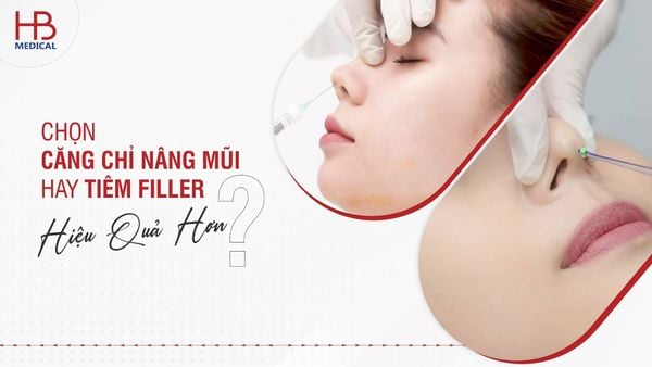 Chọn căng chỉ nâng mũi hay tiêm filler hiệu quả hơn?