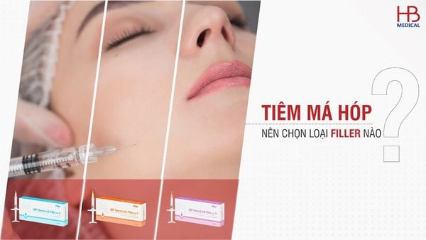 Tiêm má hóp nên chọn loại filler nào?