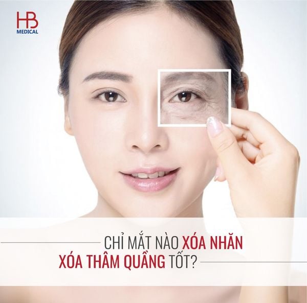 Chỉ mắt nào xóa nhăn, xóa thâm quầng tốt?
